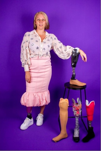 Smiling woman standing beside her three prosthetic legs and one prosthetic foots